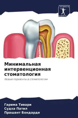 Produktbild von Minimal'naq interwencionnaq stomatologiq