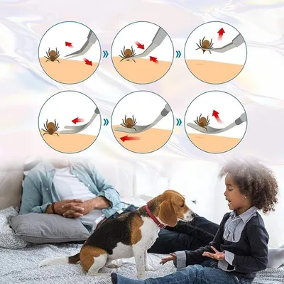 Produktbild von Zeckenentferner - Zeckenentferner Hund - Zeckenentferner Katze - Zeckenentferner Set - Zeckenentferner Set - Zeckenentferner Set - Zeckenentferner Pinzette - Zecken Entferner