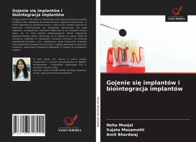 Produktbild von Gojenie si¿ implantów i biointegracja implantów