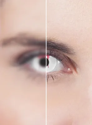 Produktbild von Blutendes Auge - Horror Halloween Kontaktlinsen Dioptrien: -3