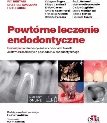 Produktbild von Powtórne leczenie endodontyczne (Buch auf Polnisch)