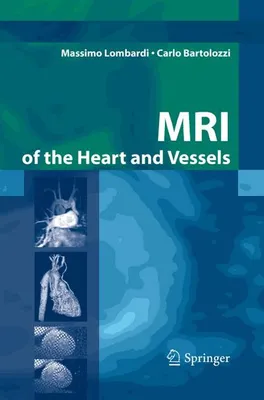 Immagine prodotto di MRI of the Heart and Vessels