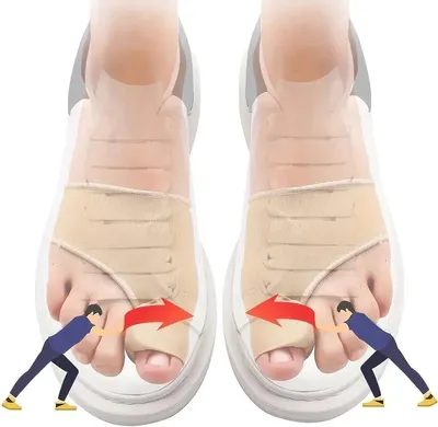 Produktbild von CHPN – Hallux Valgus – Zehen schützen – Zehenkorrektur – Knöchel – Korrigieren und glätten Sie Ihre Zehen mit diesen Zehenspreizern – 1 Paar – Zehenspreizer