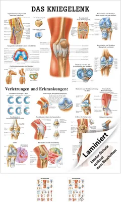 Produktbild von Das Kniegelenk Lehrtafel Anatomie 100x70 cm medizinische Lehrmittel