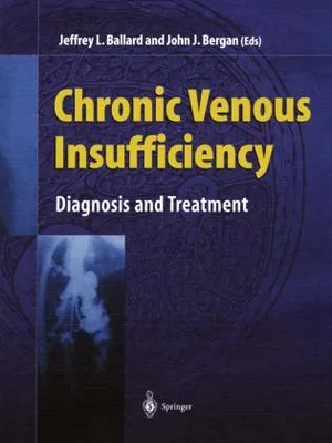 Obrázok produktu pre Chronic Venous Insufficiency