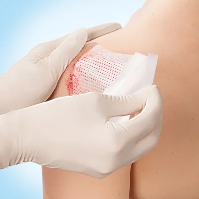 Obrázek produktu pro Cuticell Contact 10x18 cm Verband 5 St