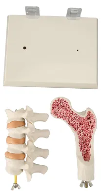 Obrázek produktu pro Model páteře s osteoporózou pro demonstraci pedagogických lézí pro klinickou výuku