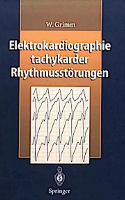 Produktbild von Elektrokardiographie tachykarder Rhythmusstörungen