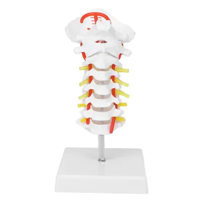 Image de Modèle de vertèbre cervicale,Modèle de colonne vertébrale artérielle,Modèle anatomique de nerfs,Modèle de colonne vertébrale cervicale humaine,Modèle de colonne vertébrale cervicale,Modèle d'artère carotide cervicale