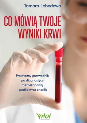 Produktbild von Was Ihre Blutwerte aussagen: Ein praktischer Leitfaden zur mikroskopischen Diagnostik und Prävention von Krankheiten