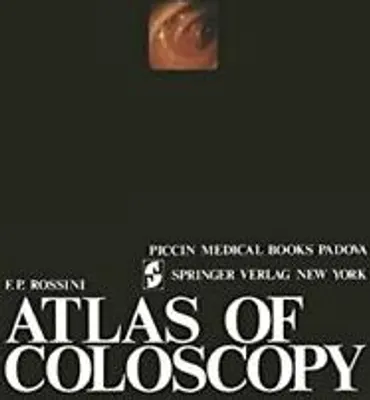 Produktbild von Atlas of coloscopy
