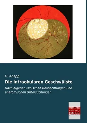 Produktbild von Die intraokularen Geschwülste