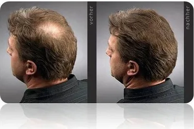 Immagine prodotto di Hairfor2 200 ml, colore: biondo chiaro