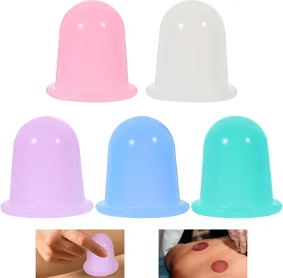 Produktbild von 5er Schröpfen Set aus Premium Silikon, hautfreundlich & transparent, starke Saugleistung, Vakuum-Therapie, Tiefenmassage gegen Muskelverspannungen & Cellulite