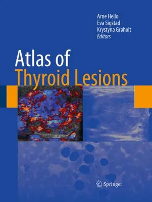 Obrázok produktu pre Atlas of Thyroid Lesions