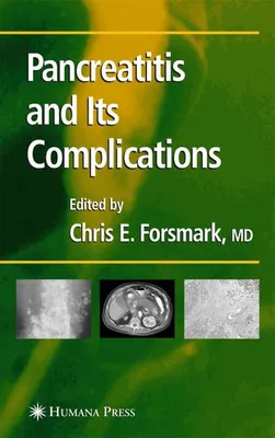 Image de Pancreatitis and Its Complications
