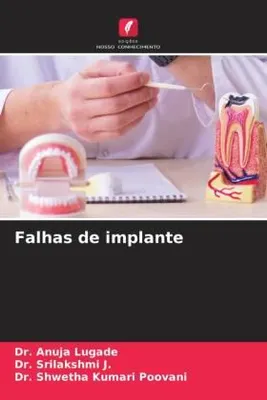 Produktbild von Falhas de implante