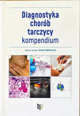 Produktbild von Diagnostyka chorób tarczycy - kompendium