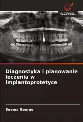 Produktbild von Diagnostyka i planowanie leczenia w implantoprotetyce