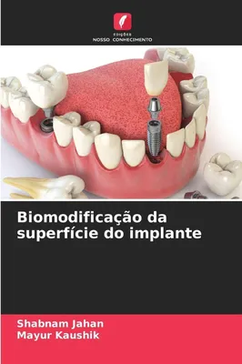Produktbild von Biomodificação da superfície do implante