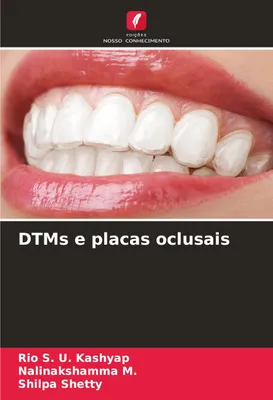 Produktbild von DTM-Schienen und Okklusionsschienen
