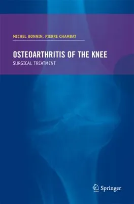 Obrázok produktu pre Osteoarthritis of the knee