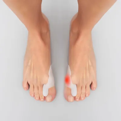 Image de InnovaGoods Silikon-Hallux-Korrektor Bunilief