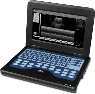 Produktbild von CE Tragbares Ultraschallgerät B-Ultraschall mit konvexen und linearen Sonden CMS600P2 Ultraschallscanner