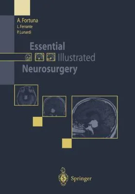Produktbild von Essential Illustrated Neurosurgery