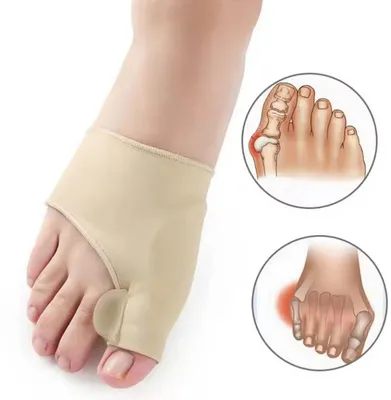 Produktbild von Hallux-Valgus-Korrektor – Zehenkorrektor – Beige – 1 Paar – weiches Gel-Pad – Einheitsgröße – Zehenschutz – CHPN