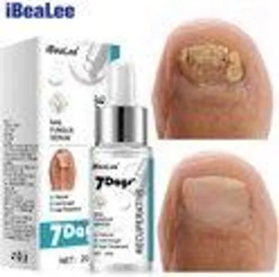 Produktbild von iBeaLee Nagelpflege Serum 20 ml – Pflege für beschädigte, verfärbte & brüchige Nägel