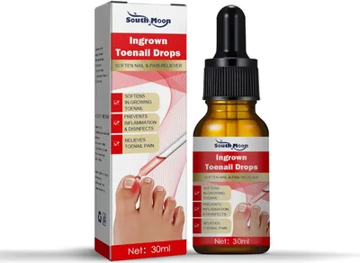 Produktbild von 30 ml，Behandlung eingewachsener Zehennägel, Schmerzlinderung bei eingewachsenen Zehennägeln, natürliche Behandlung zur Korrektur eingewachsener Zehennägel, Tropfen zum einfachen Trimmen von Zehennägeln，Maniküre-Sets