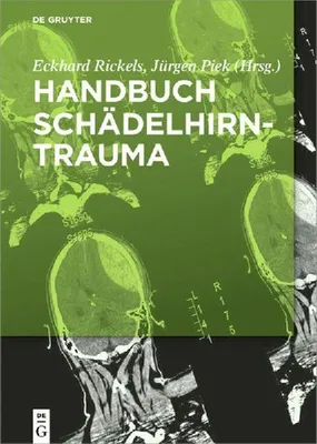 Produktbild von Handbuch Schädelhirntrauma