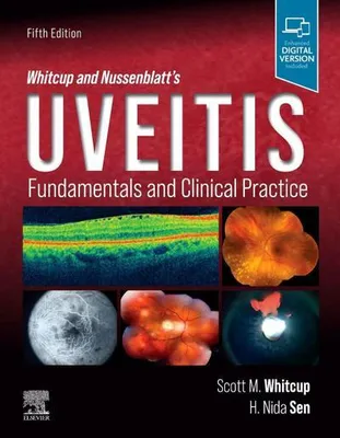 Zdjęcie produktu dla Whitcup and Nussenblatt's Uveitis