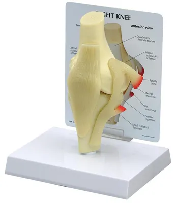 Anatomisches Kniemodell, Originalgröße, mit Karte