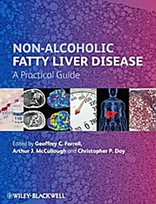 Image de Non-Alcoholic Fatty Liver Disease