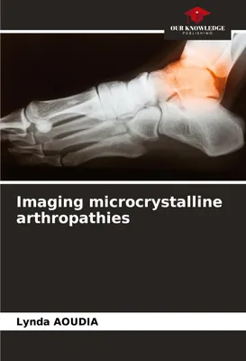 Produktbild von Bildgebung von mikroKristallinen Arthropathien