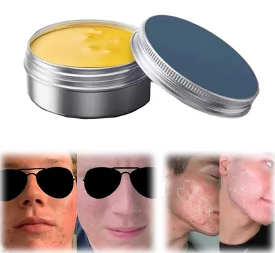 Productafbeelding van Acne Balm en Huidverzorgingsset voor Acne en Roodheid