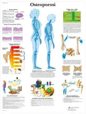 Obrázek produktu pro Poster osteoporose