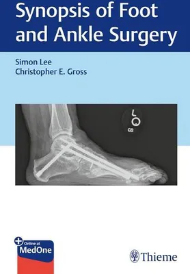 Obrázok produktu pre Synopsis of Foot and Ankle Surgery