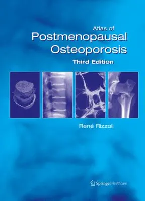 Obrázok produktu pre Atlas of Postmenopausal Osteoporosis