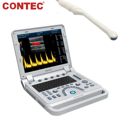 Produktbild von Farbdoppler-Ultraschallgerät mit transvaginaler Sonde, Laptop