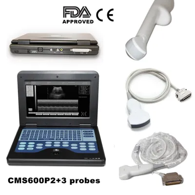 Immagine prodotto di CMS600P2 Dispositivo portatile a ultrasuoni Dispositivo diagnostico portatile con 3 sonde convesse lineari transvaginali