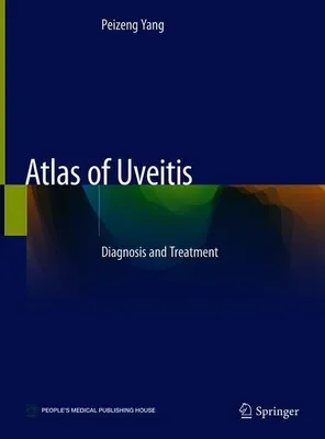 Produktbild von Atlas of Uveitis