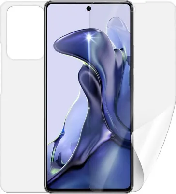 Obrázek produktu pro Screenshield XIAOMI 11T na celé tělo