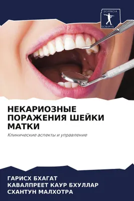 Produktbild von NEKARIOZNYE PORAZhENIYa ShEJKI MATKI