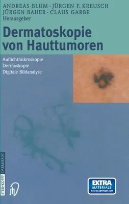 Obrázek produktu pro Dermatoskopie von Hauttumoren