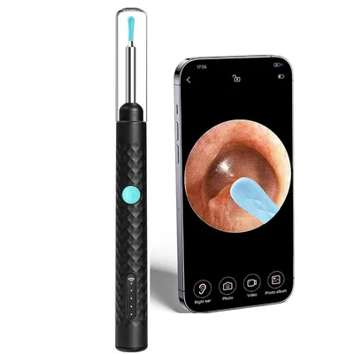 Produktbild von WiFi-Ohrreiniger mit 1080P, 360° Weitwinkel-Ohrkamera (3,5 mm) und 6 LED-Leuchten, kompatibel mit iOS & Android, geeignet für Kinder und Haustiere