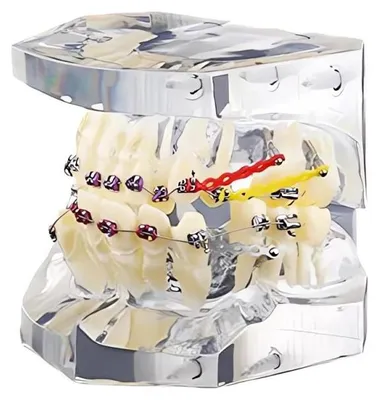 Produktbild von Verk 27403 Kieferorthopädisches Zahnmodell