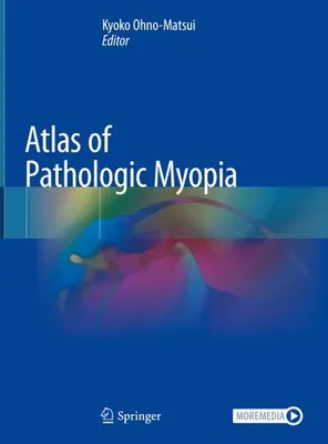 Produktbild von Atlas of Pathologic Myopia